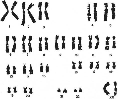 46 хромосом 1. 46 Хромосом у человека. В каждой клетке человека 46 хромосом. Хромосома на белом фоне. Человеческие клетки хромосомы.